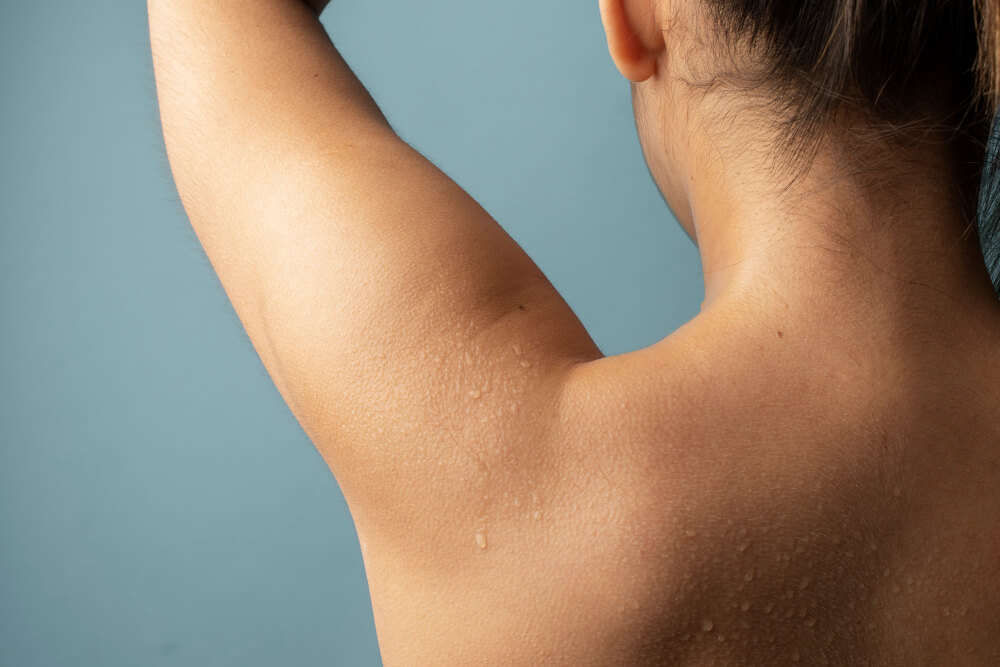 Hiperhidrosis